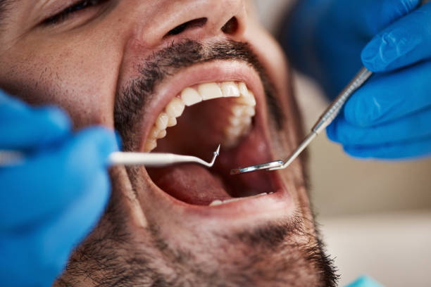 Best Broken or Cracked Tooth Emergency Dentist in Floydada, TX